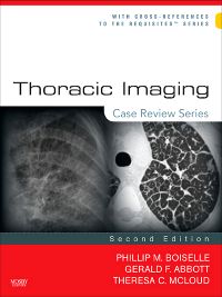 Thoracic Imaging: Case Review Series