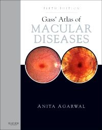 Gass' Atlas of Macular Diseases