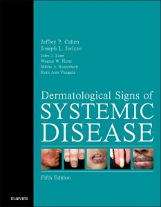 Dermatological Signs of Systemic Disease