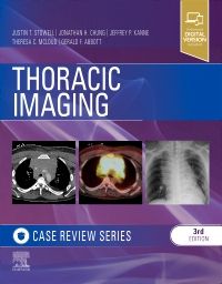 Thoracic Imaging: Case Review Series