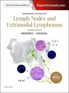 Diagnostic Pathology: Lymph Nodes and Extranodal Lymphomas