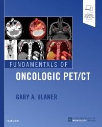 Fundamentals of Oncologic PET/CT