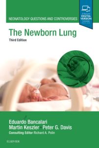 The Newborn Lung