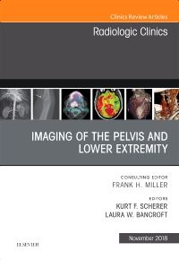 Imaging of the Pelvis and Lower Extremity, An Issue of Radiologic Clinics of North America