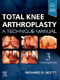 Total Knee Arthroplasty