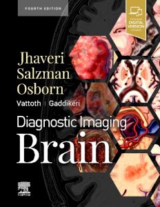 Diagnostic Imaging: Brain