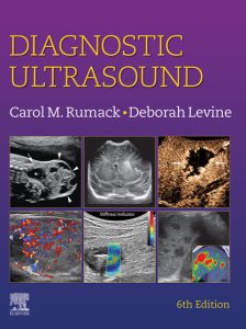 Diagnostic Ultrasound