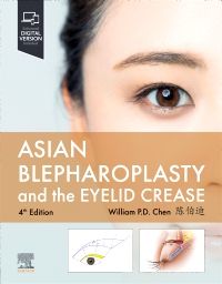 Asian Blepharoplasty and the Eyelid Crease