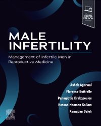 Male Infertility