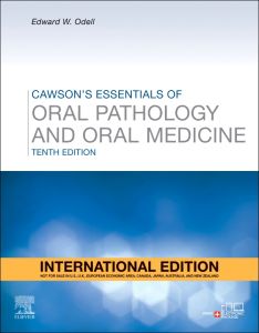 Cawson's Essentials of Oral Pathology and Oral Medicine, International Edition