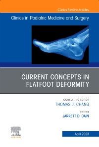 Current Concepts in Flatfoot Deformity , An Issue of Clinics in Podiatric Medicine and Surgery