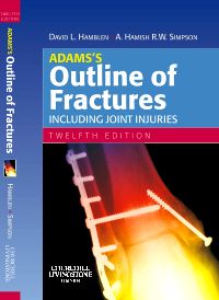 Adams's Outline of Fractures