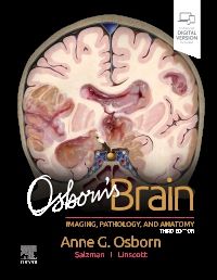 Osborn's Brain