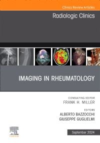 Imaging in Rheumatology, An Issue of Radiologic Clinics of North America, E-Book