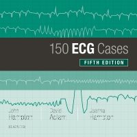 150 ECG Cases