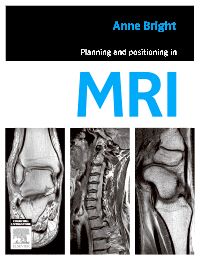 Planning and Positioning in MRI - E-Book