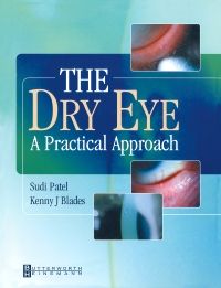 The Dry Eye