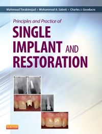 Principles and Practice of Single Implant and Restoration