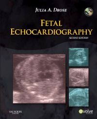 Fetal Echocardiography - E-Book