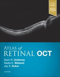 Atlas of Retinal OCT: Optical Coherence Tomograp - 9780323461214