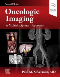 Oncologic Imaging: A Multidisciplinary Approach - 9780323695381 | Elsevier  Health