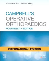 Campbell's Operative Orthopaedics, 4-Volume Set - 9780323672184 ...