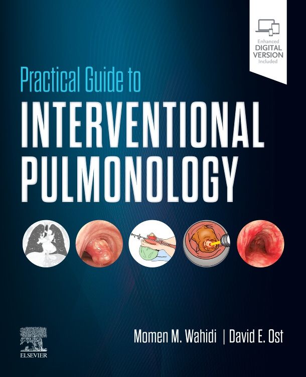 Practical Guide To Interventional Pulmonology - 9780323709545 ...