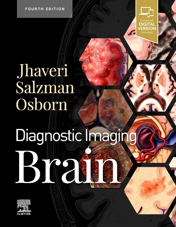 Diagnostic Imaging: Brain - 9780323756204 | Elsevier Health