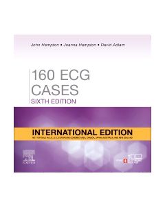 160 ECG Cases, International Edition