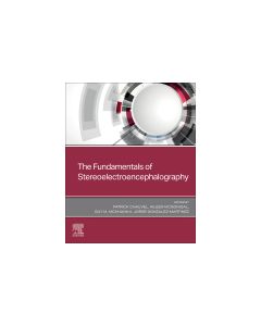 The Fundamentals of Stereoelectroencephalography