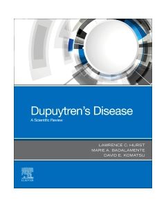 Dupuytren's Disease