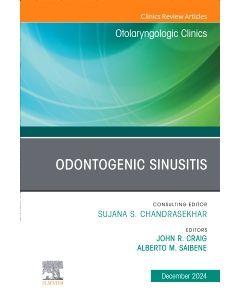 Odontogenic Sinusitis, An Issue of Otolaryngologic Clinics of North America